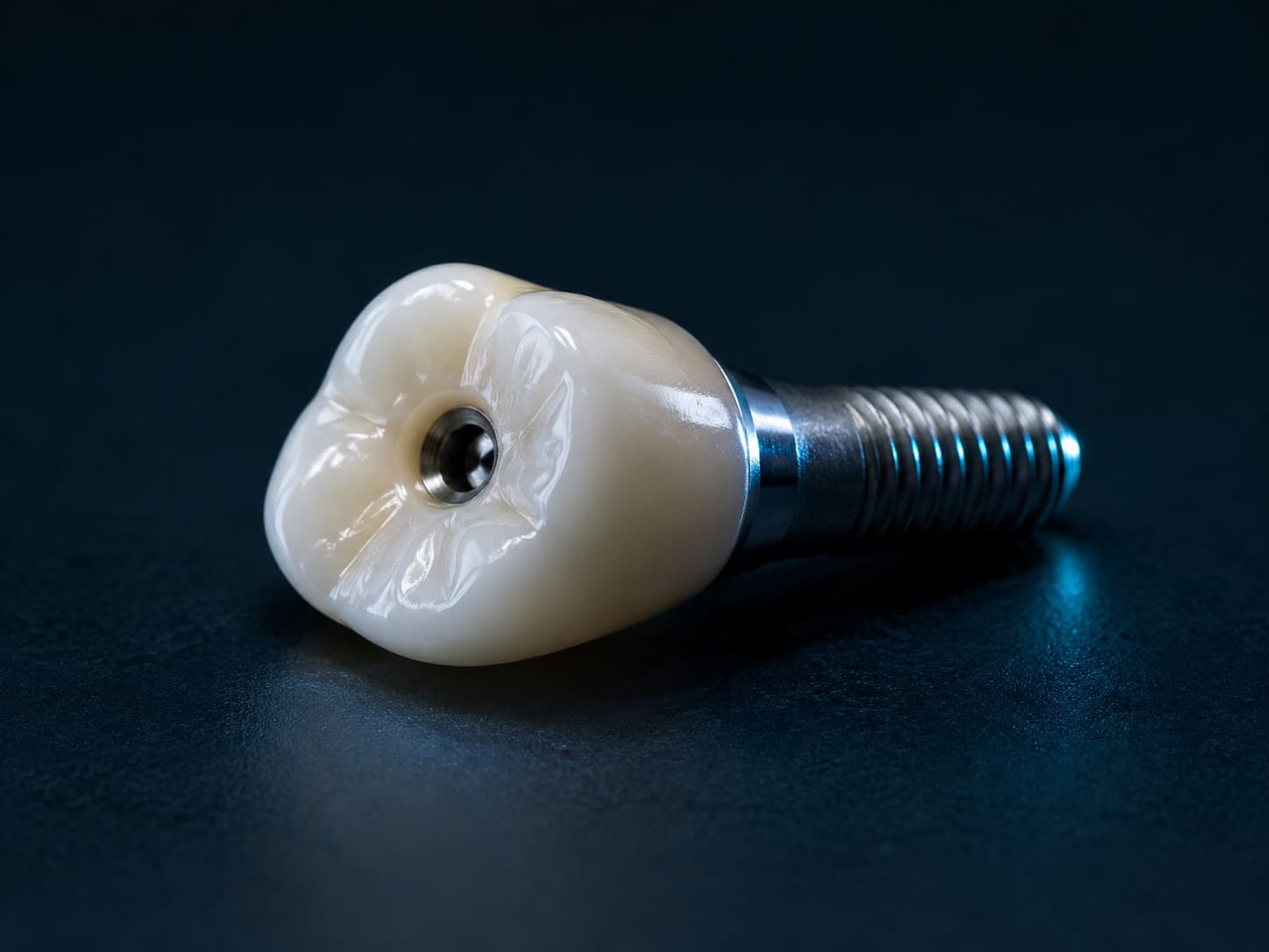 Verschraubte Implantatkrone von der Seite, Schraubenkanal in der Kaufläche sichtbar.